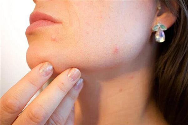 颧骨或下颚断裂