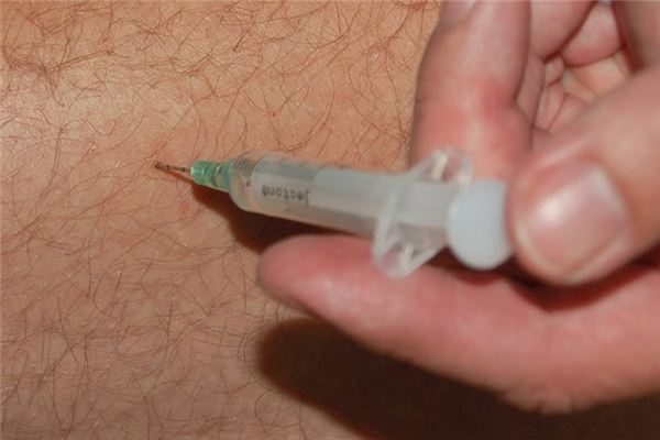 梦见扎针是什么意思 梦见扎针是什么意思